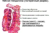 Мигдалики в горлі їх значення, розташування та функції горлі