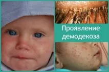 Чи можуть воші з’явитися на нервовому ґрунті явитися