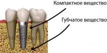 тъкан костна