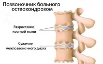 заболяването причините