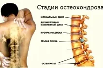 причините заболяването