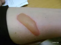бърнс бърнс