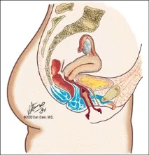 кегел pelvic