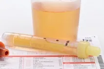 Плівка на сечі (біла, райдужна). біла