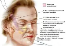 Підтяжка середньої зони обличчя, що потрібно знати зони