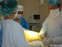байпас хирургия лечение