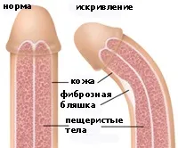 симптоми симптоми