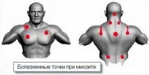 Болить правий бік зі спини причини, лікування болю в спині праворуч причини