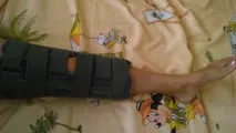 Болі в колінах причини та лікування болю