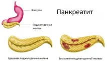 Болить правий бік зі спини причини, лікування болю в спині праворуч болить