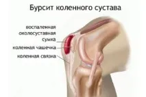 коляното препателарен