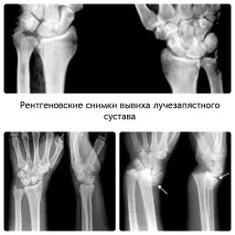 руки