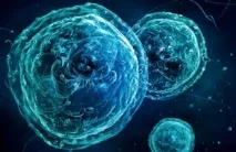 Солітарна плазмоцитома симптоми та діагностика, Onkostatus симптоми