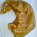 Збіг або знак мене