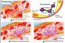 хемостаза тромбоцитно-съдова