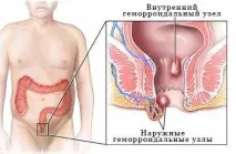 алтернативна алтернативна