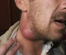 народни възли