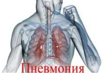 възпаление възпаление