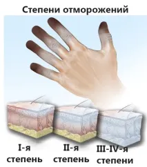 измръзване първа