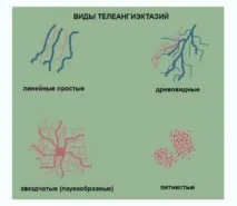 ретикуларната ретикуларната