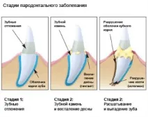 снимка зъбен