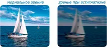 Астигматизм досягнення офтальмології у боротьбі зі слабким зором досягнення