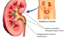 камъни Съдържание скрий