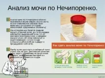 Аналізи при циститі циститі