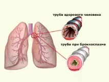 Імунорікс - імуномодулятор для профілактики інфекційних захворювань імунорікс