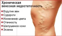 Центр сучасної флебології та профілактичної медицини лікування судинної патології сучасної