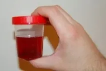 опасността каква