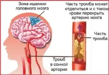 Центр сучасної флебології та профілактичної медицини лікування судинної патології центр