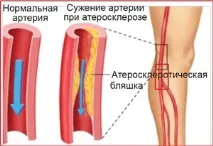 Центр сучасної флебології та профілактичної медицини лікування судинної патології сучасної