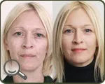 пилинг лице пилинг лице
