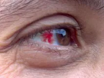 Що лікарі можуть сказати про ваше здоров’я, просто зазирнувши у вічі можуть
