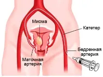 артерии като
