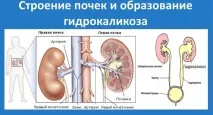 лівий