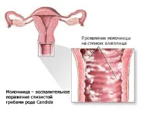 чому