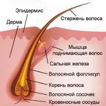 коса причини