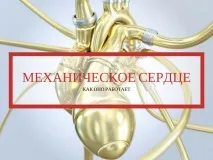 Як працює механічне серце механічне