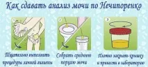 Як здавати сечу по нечипоренко при вагітності, що показує і як збирати аналіз аналіз сечі по вагітності