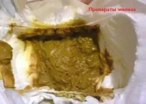 кръв изпражненията бебе