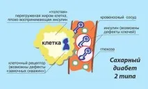 захарен диабет критерии