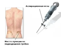ДІАГНОСТИКА ЗЛОЯКІСНИХ ПУХЛИН КІСТОК злоякісних