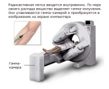 ДІАГНОСТИКА ЗЛОЯКІСНИХ ПУХЛИН КІСТОК злоякісних