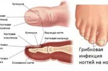 Лікування грибка стопи при вагітності лікування
