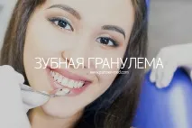 Лікування гранульоми на корені зуба, причини, симптоми, видалення гранульоми причини