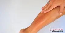 кожа много