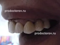 Відгуки 48 пацієнтів про Стоматологія «Всі свої» на Родіонова в Нижньому Новгороді стоматологія