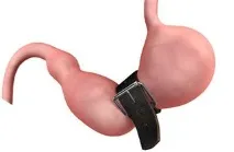 ассута обща хирургия